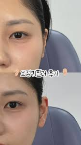 Korean beauty trend